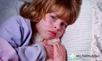 ПСЕВДОКРАСНУХА: В ЧЁМ ОПАСНОСТЬ?